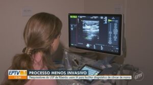 Imagem descritiva Pesquisa da USP Aumenta a Precisão de Diagnóstico do Câncer de Mama com Inteligência Artificial